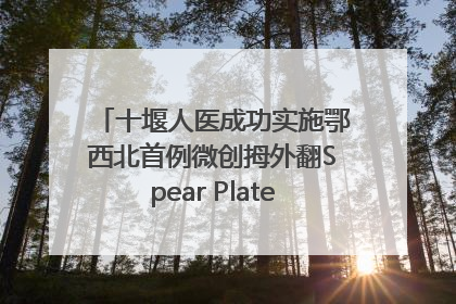 十堰人医成功实施鄂西北首例微创拇外翻Spear Plate髓内板矫形术